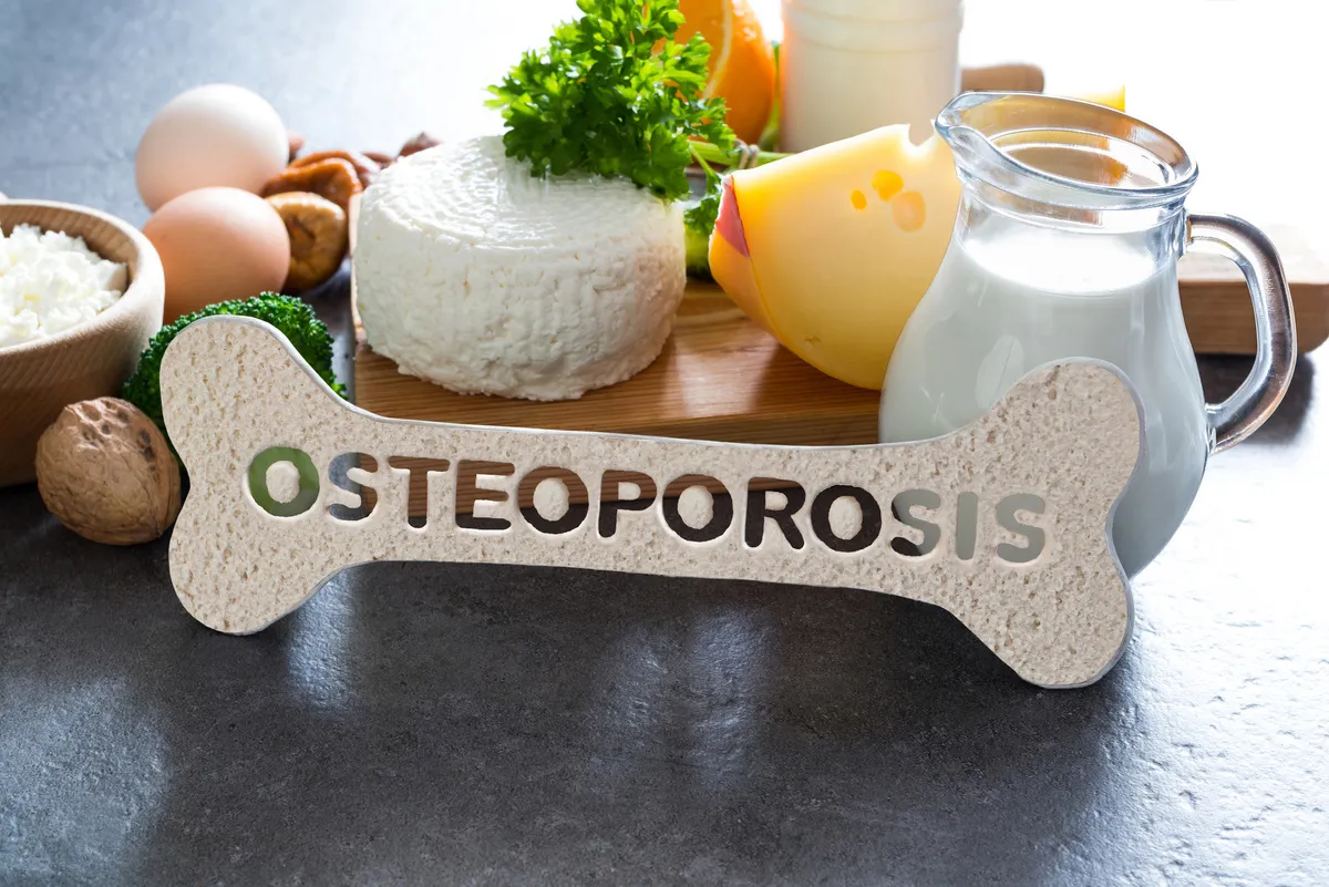 osteoporosis-1